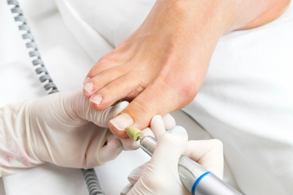 Pédicure – entre soin médical et beauté des pieds