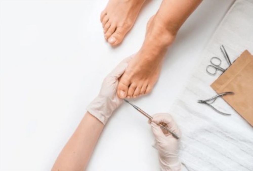 Onychoplastie : réparer et protéger les ongles