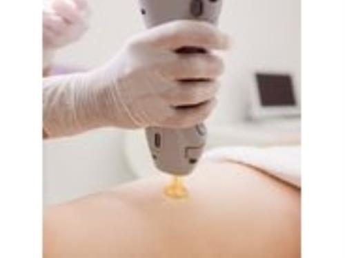 Epilation - Medical Laser Diode System