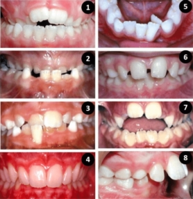 Orthodontie pour les enfants
