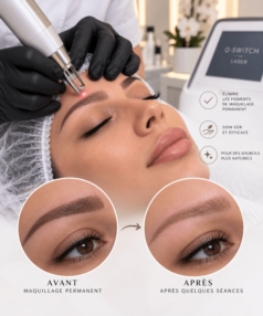 Détatouage du maquillage permanent
