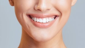 Beauté du sourire