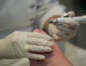 Traitement des ongles à problèmes