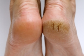 Des mains et des pieds soignés toute l’année