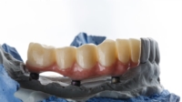 Artikel vonDental Weber (Laboratoire Dentaire)