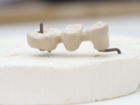 Artikel vu Optident Sàrl