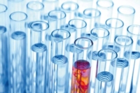 Article fromLaboratoire d'Analyses Médicales Ketterthill